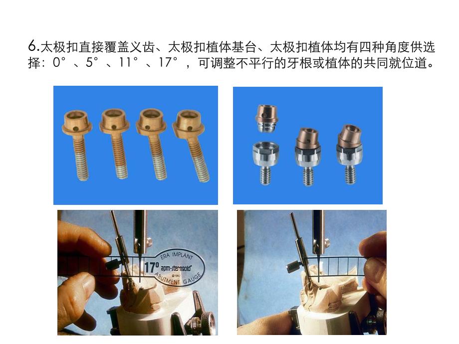 太极扣附着体修复技术2.ppt_第1页