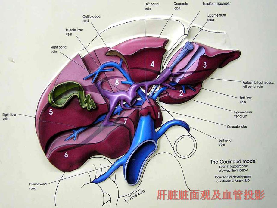 肝脏八段分法的影像学解剖示意图.ppt_第3页