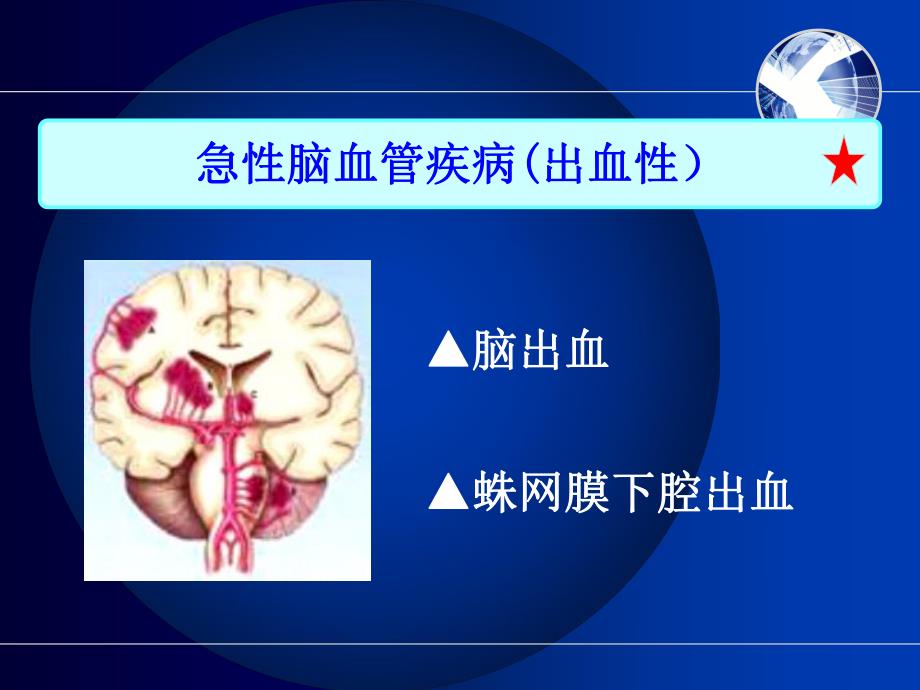 脑出血的护理1幻灯片.ppt_第3页