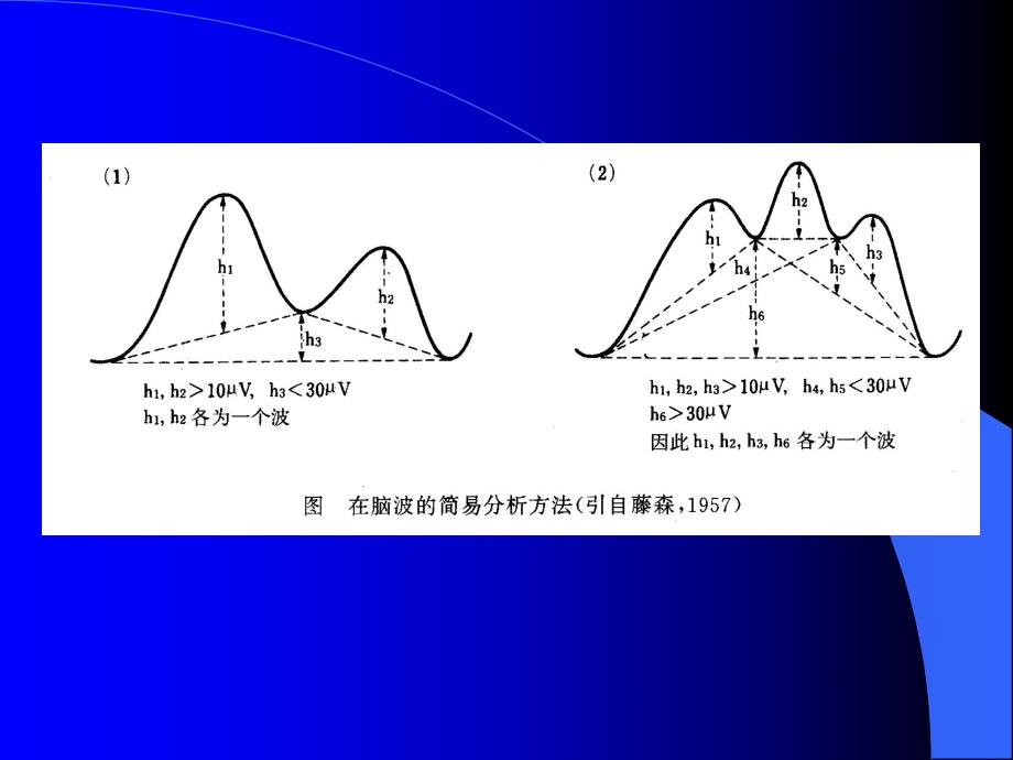 脑电图基本知识.ppt_第3页