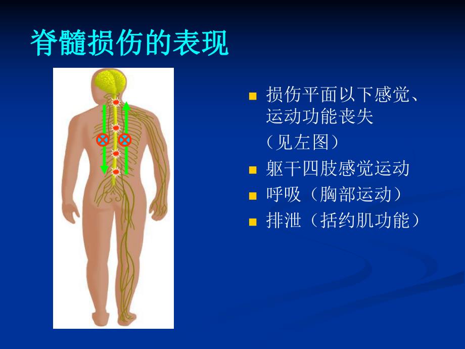 脊柱脊髓损伤的临.ppt_第3页