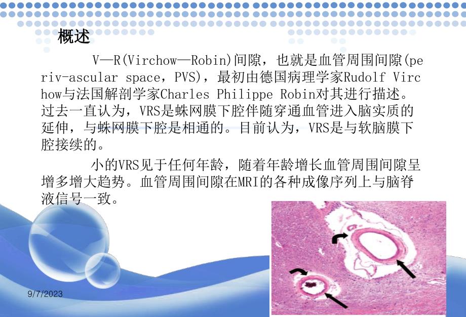 vr间隙mr成像表现ppt课件.ppt_第2页