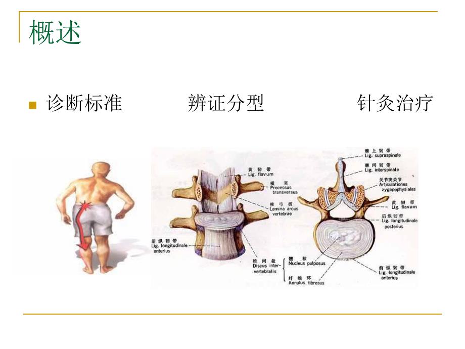 腰椎间盘突出症的针灸治疗.ppt_第2页