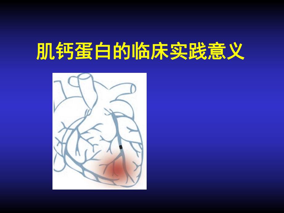 肌钙蛋白的临床实践意义.ppt_第1页