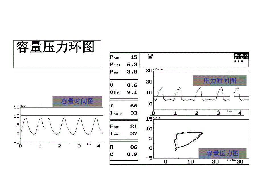 呼吸麻醉教学资料呼吸曲线及环的简要介绍.ppt_第2页