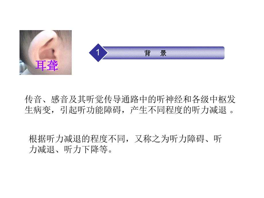 耳聋基因诊断.ppt_第3页