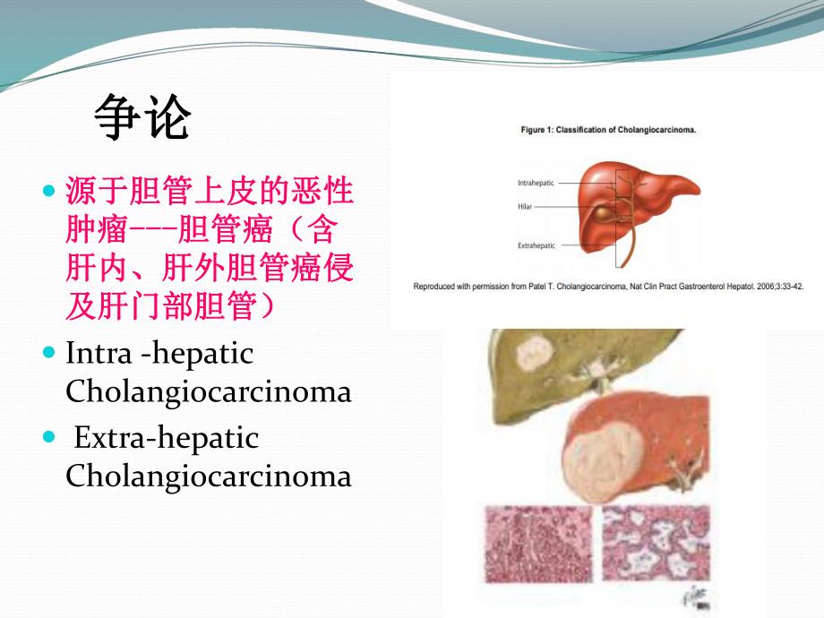 胆管癌外科治疗ppt课件.ppt_第3页