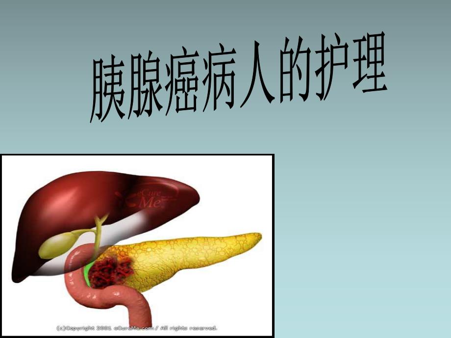 胰腺癌病人的护理.ppt_第1页