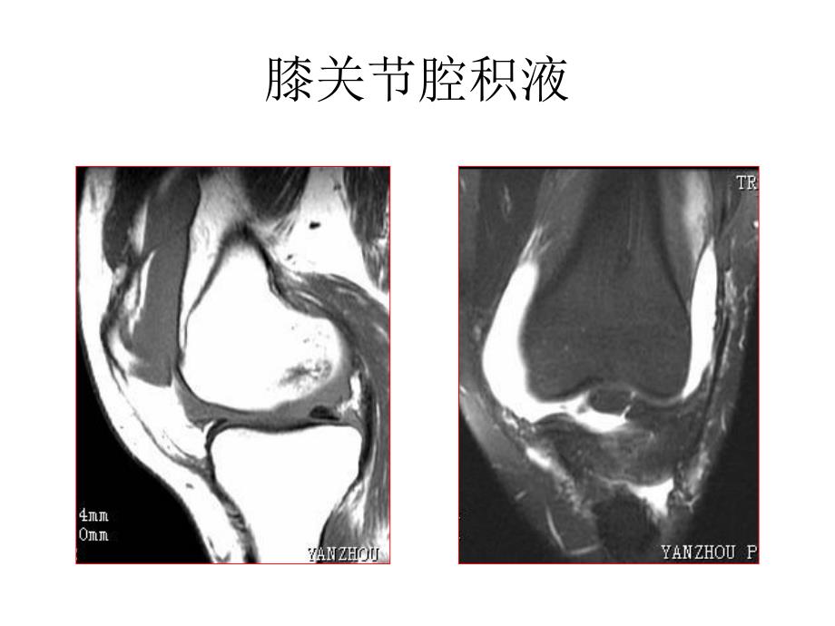 脊柱骨胳系统MRI图片.ppt_第2页