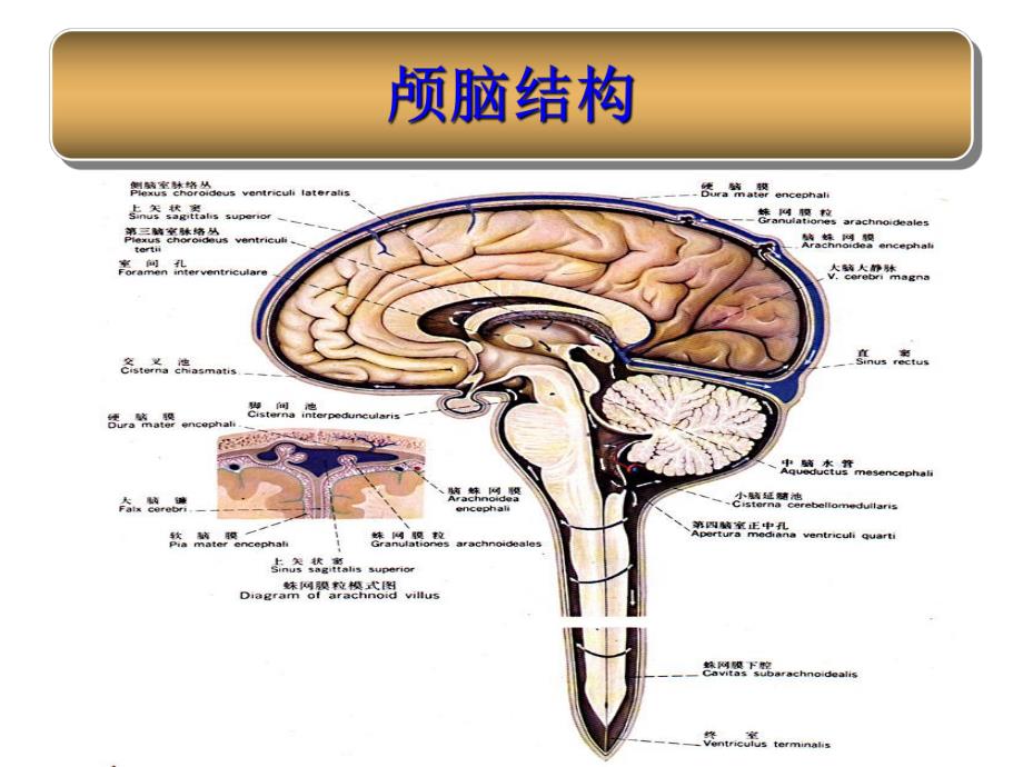 蛛网膜下腔出血护理.ppt_第2页