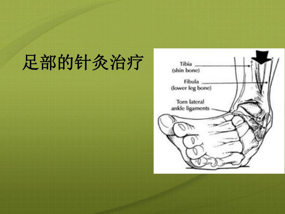 足痛的针灸治疗.ppt_第1页