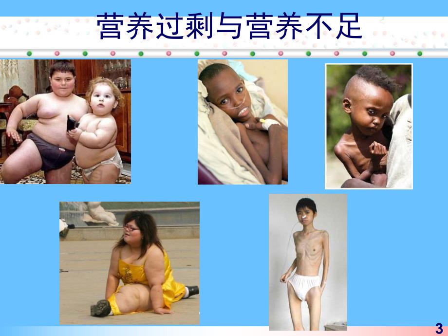 营养风险筛查与评估.ppt_第3页