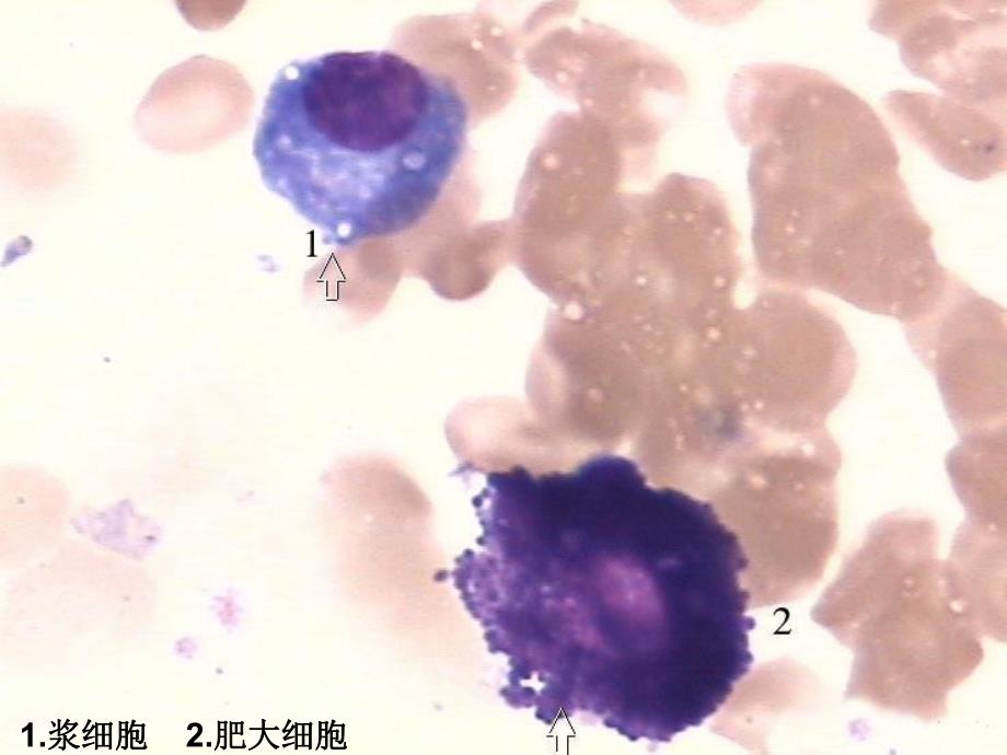 血细胞图片小测.ppt_第1页