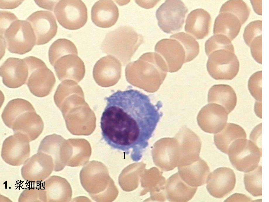 血细胞图片小测.ppt_第2页