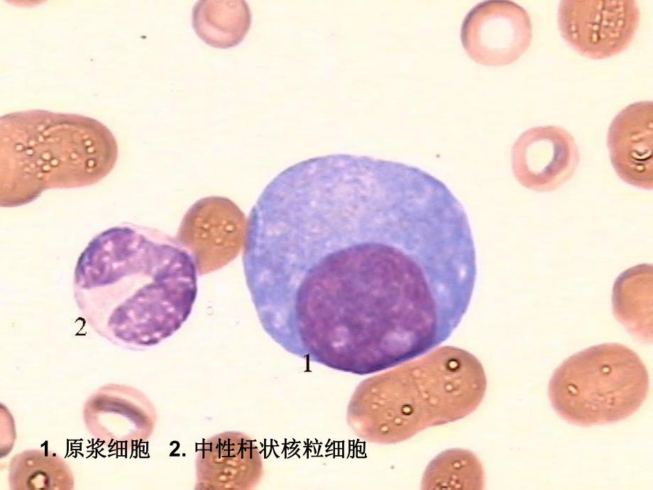 血细胞图片小测.ppt_第3页