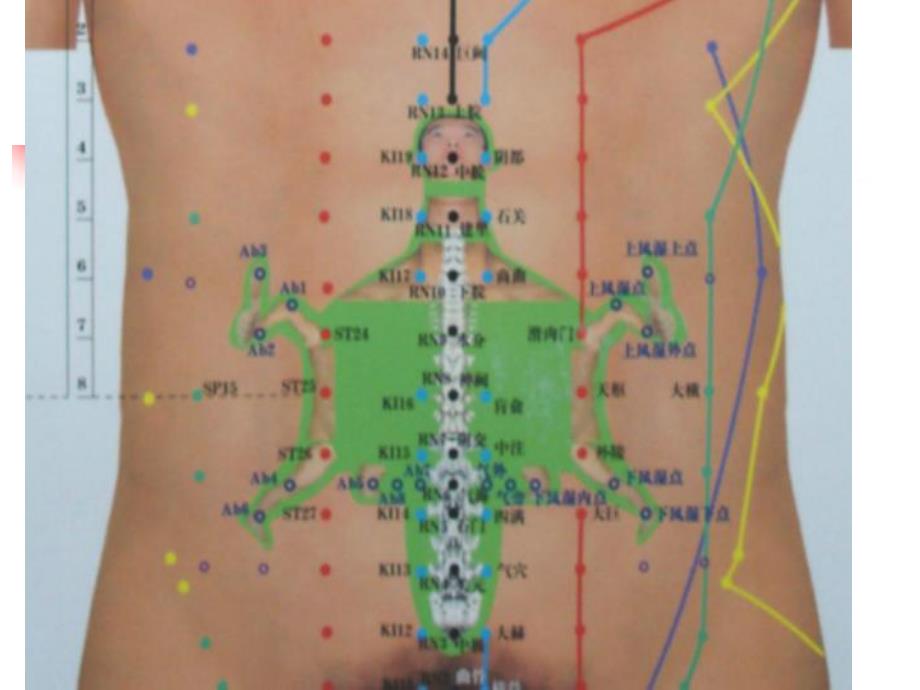 腹针疗法学习腹针.ppt_第3页