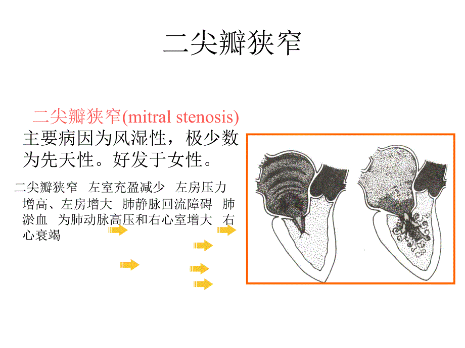 诊断学循环系统常见疾病.ppt_第2页