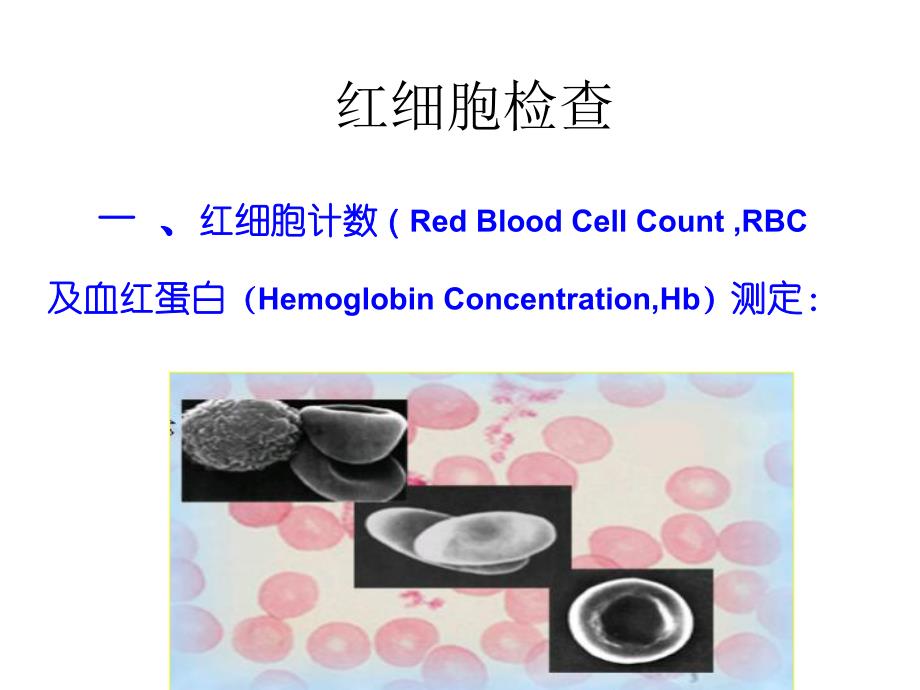 血常规检查及其意义.ppt_第3页