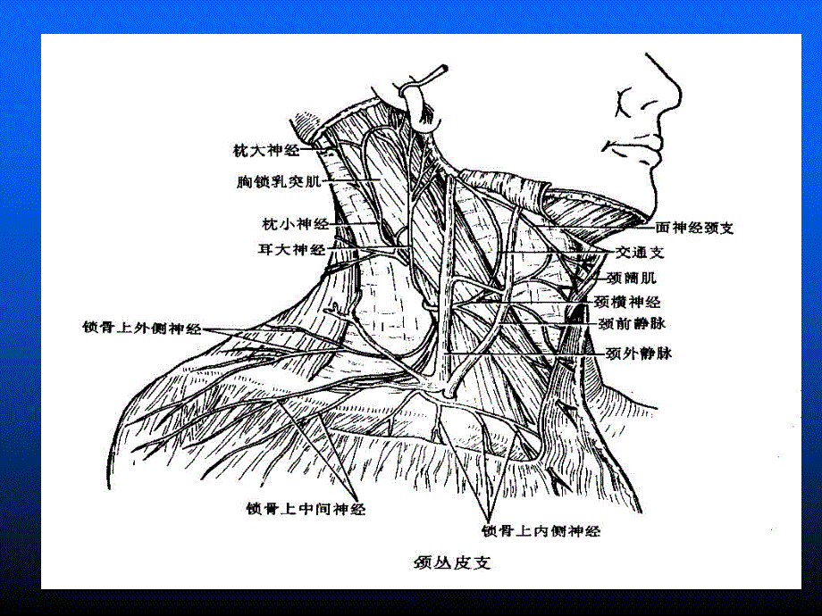 臂丛神经阻滞副本.ppt_第3页