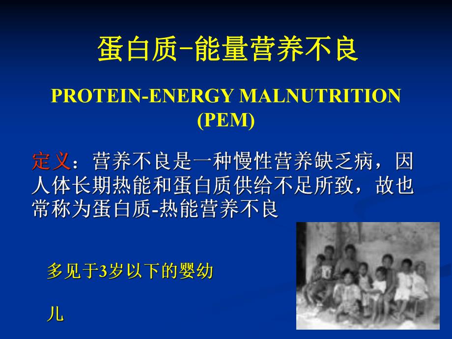 营养缺乏性疾病.ppt_第2页