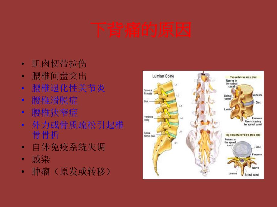 腰背问题探究和保健.ppt_第2页