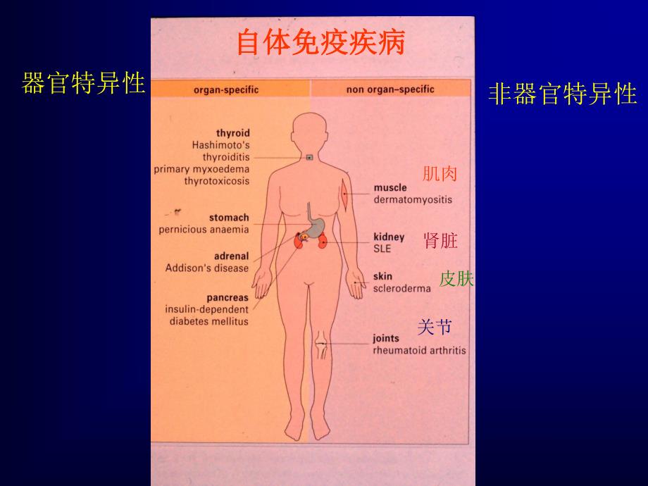 自体免疫疾病.ppt_第2页