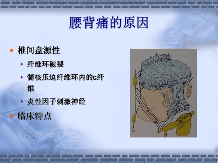 腰背痛神经阻滞疗法.ppt_第2页