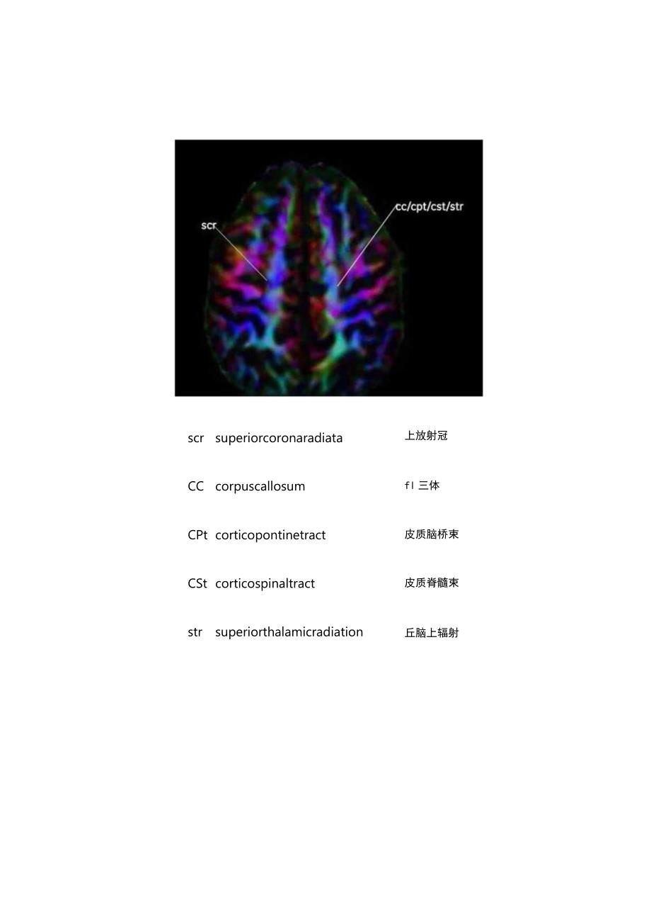 脑白质DTI高清解剖图谱（一）.docx_第2页