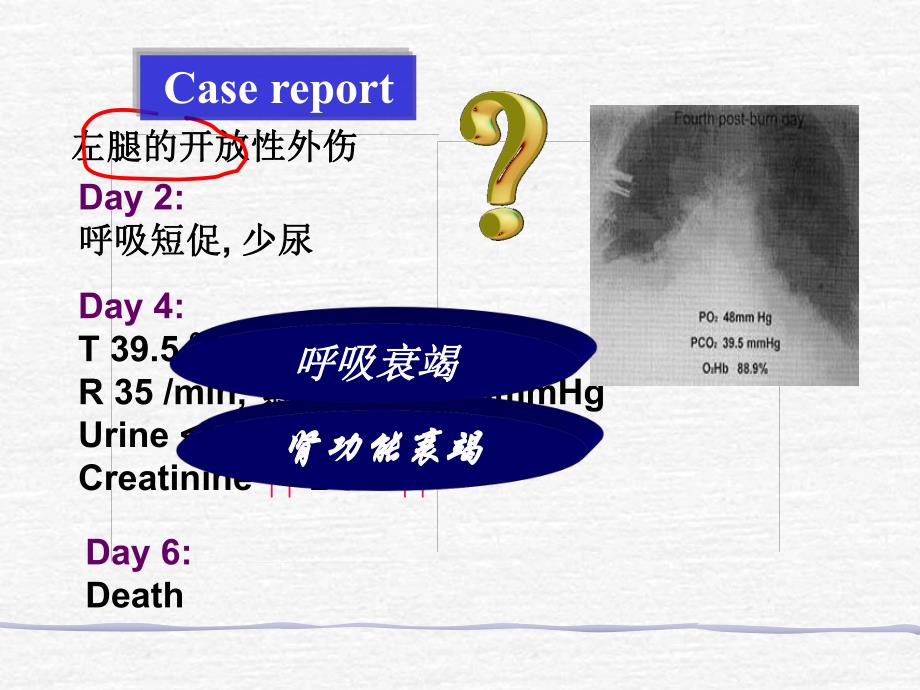 多器官功能障碍综合症MODS.ppt_第2页