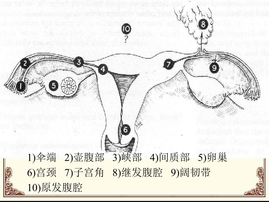 宫外孕护理大查房.ppt_第3页