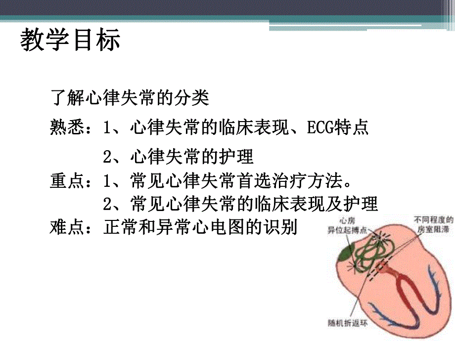 心律失常患者的护理.ppt.ppt_第2页