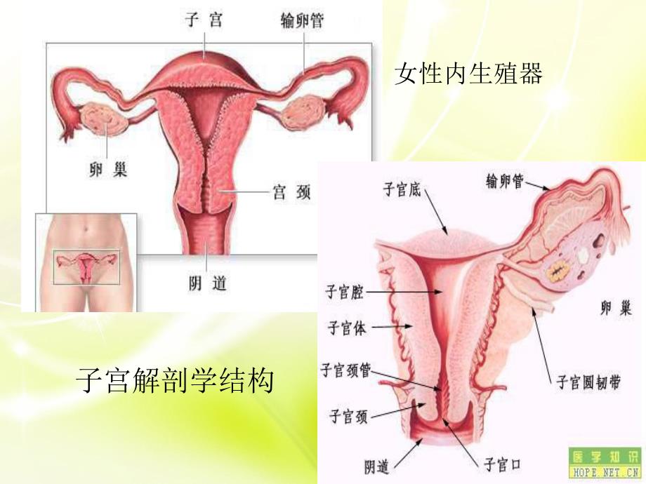 子宫内膜癌.ppt_第2页