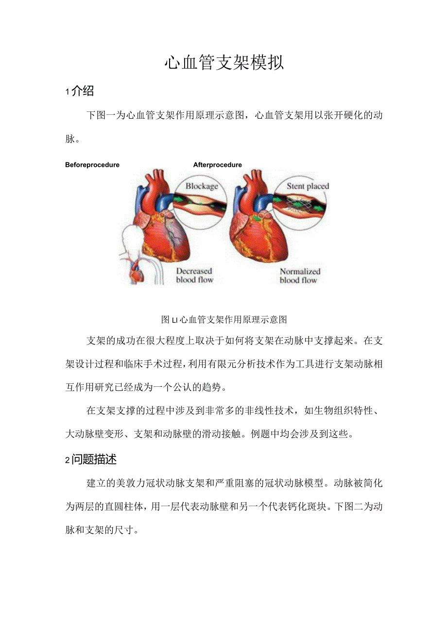 CAE-心血管支架模拟.docx_第1页