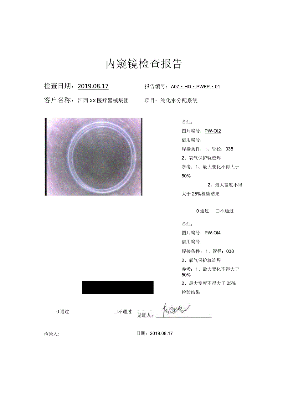 PW管道 内窥镜检查报告60张.docx_第2页