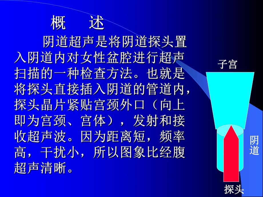 阴道超声.ppt_第2页