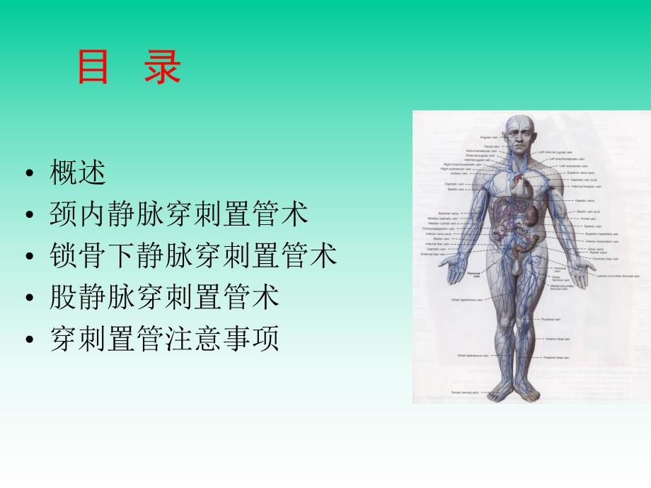 中心静脉穿刺置管术.ppt_第2页