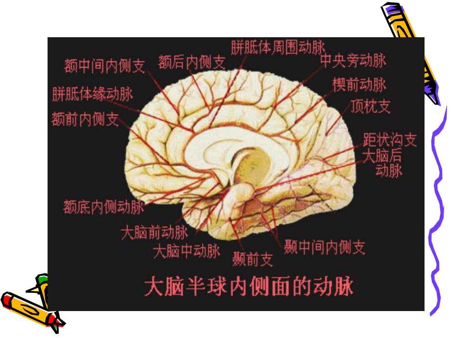 【外科护理学】常见颅脑疾病病人的护理.ppt_第3页