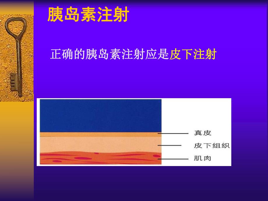 【精品PPT】胰岛素注射技术.ppt_第3页