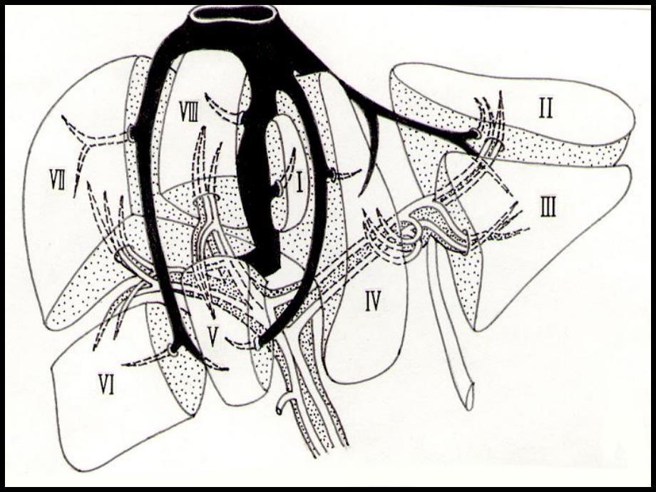 09肝内管道和肝段断层解剖.ppt_第3页