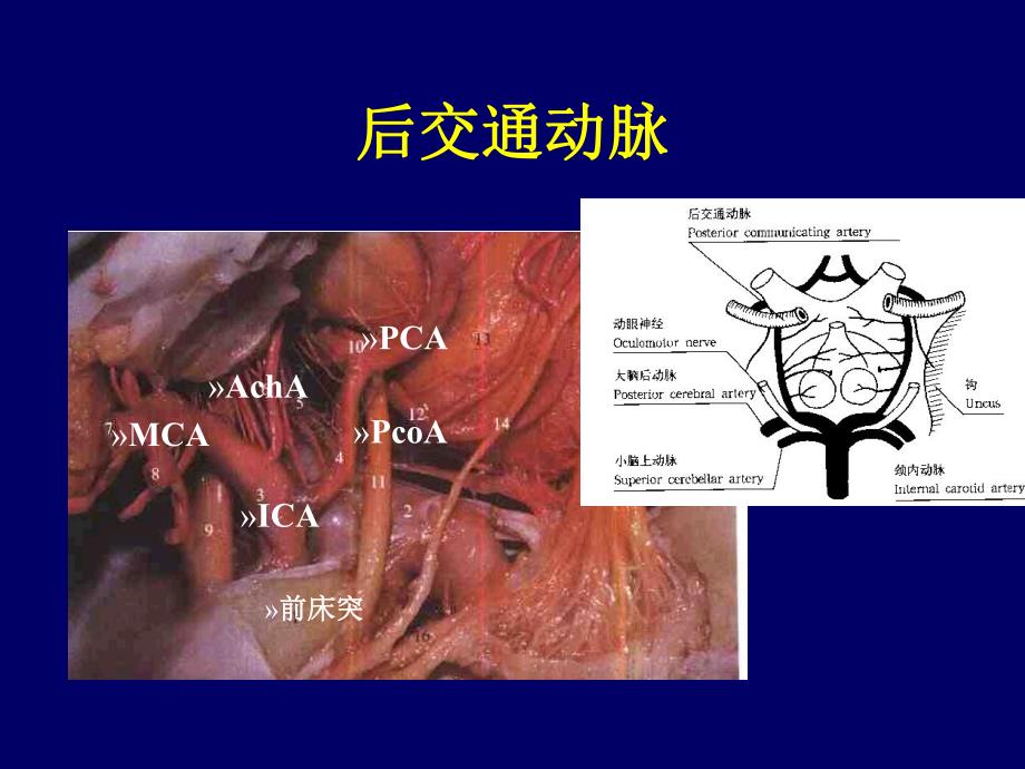 [临床医学]丘脑底节区脑血管解剖.ppt_第3页