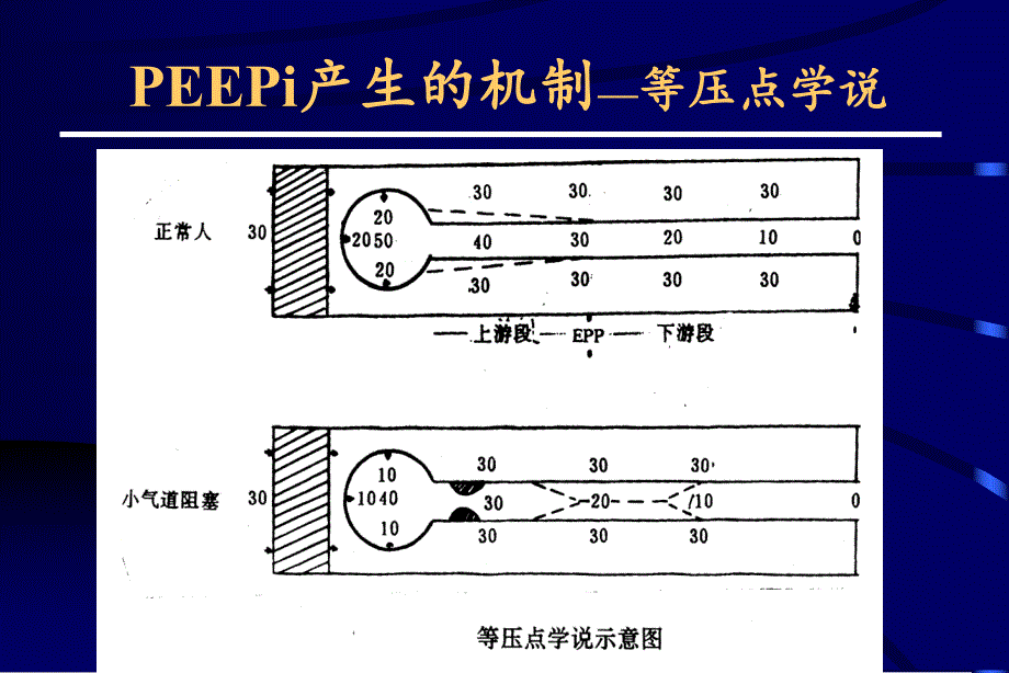 COPD所致肺心病急性加重期的治疗进展.ppt_第3页