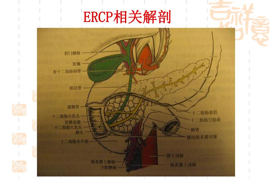 ERCP业务学习.ppt_第3页