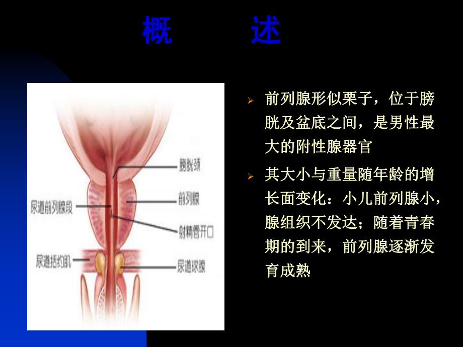 前列腺炎(PPT65).ppt_第3页