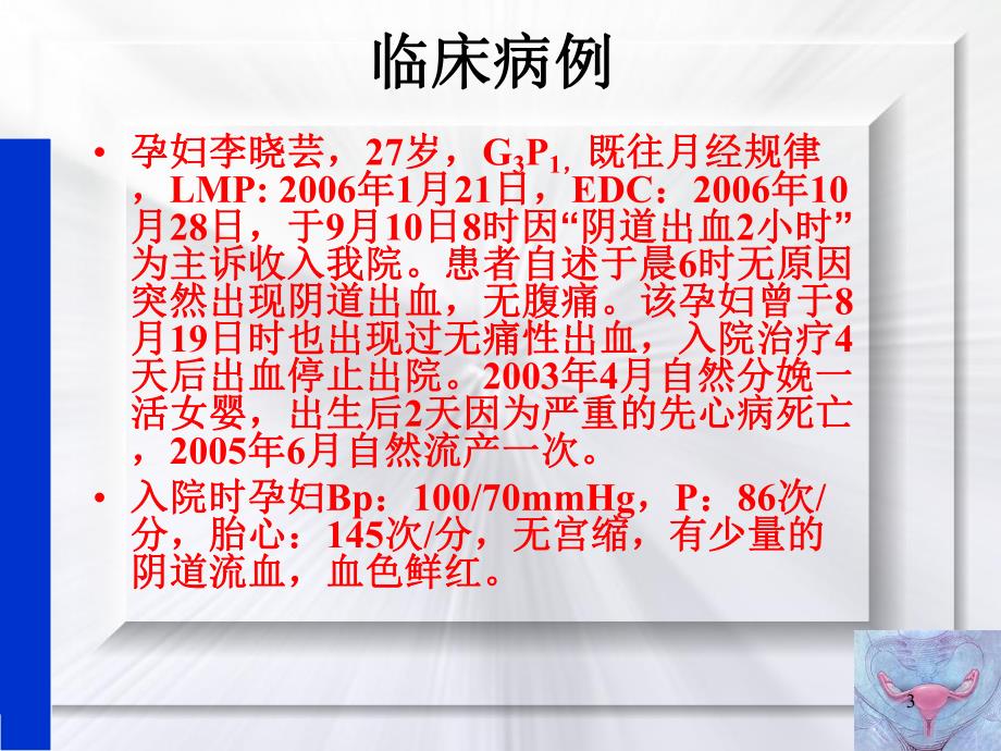 前置胎盘.ppt_第3页