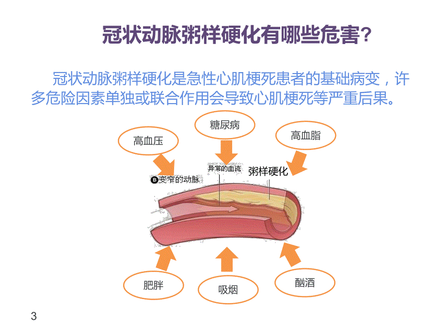 冠心病患者如何改善生活方式.ppt_第3页