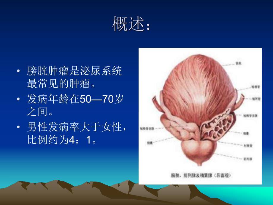 医院泌尿肛肠外科培训资料 膀胱肿瘤培训资料PPT演示文稿.ppt_第2页