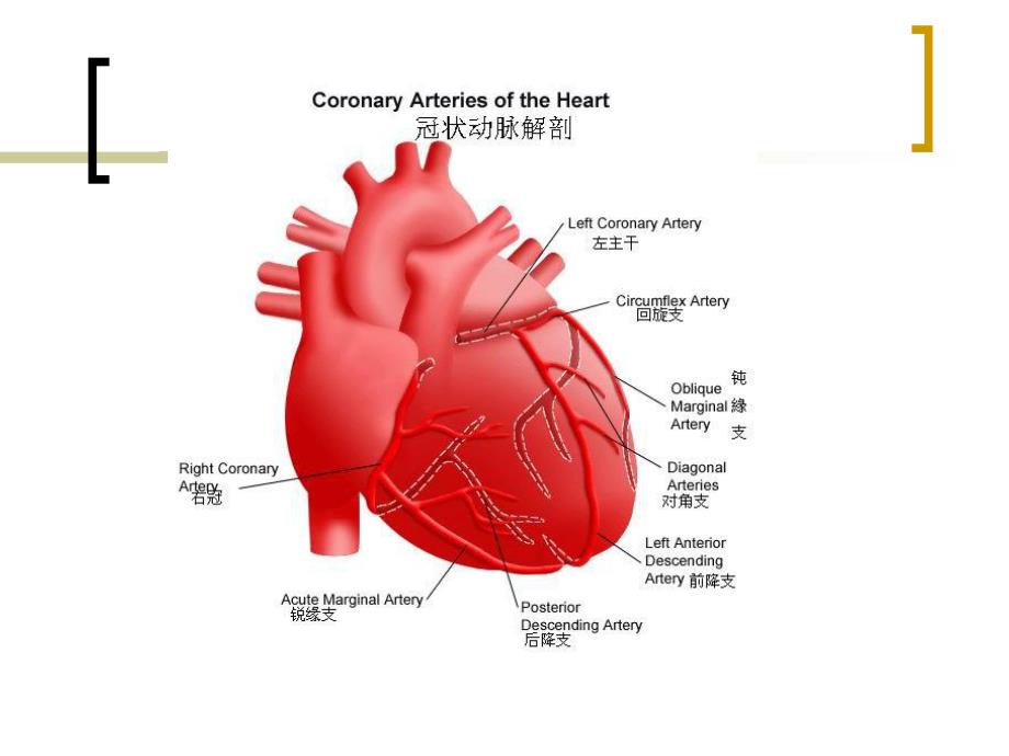 冠脉搭桥术后护理.ppt_第3页