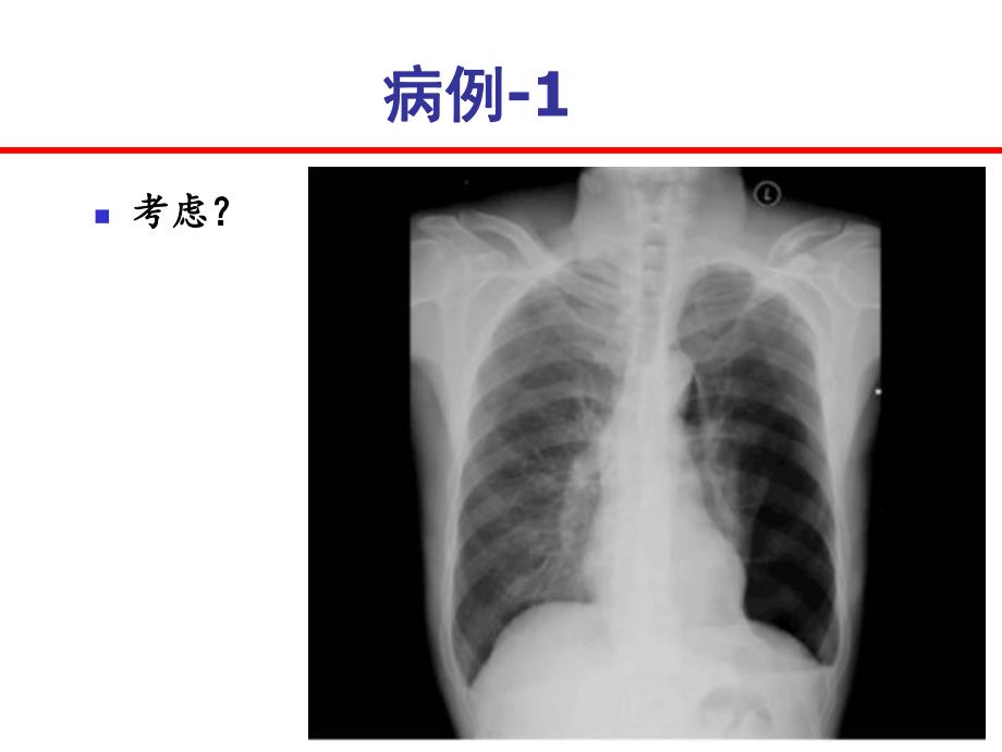 危重症患儿的早期识别.ppt_第3页