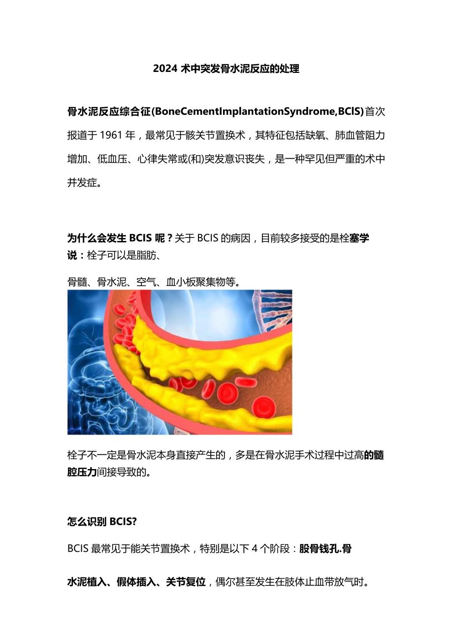 2024术中突发骨水泥反应的处理.docx_第1页