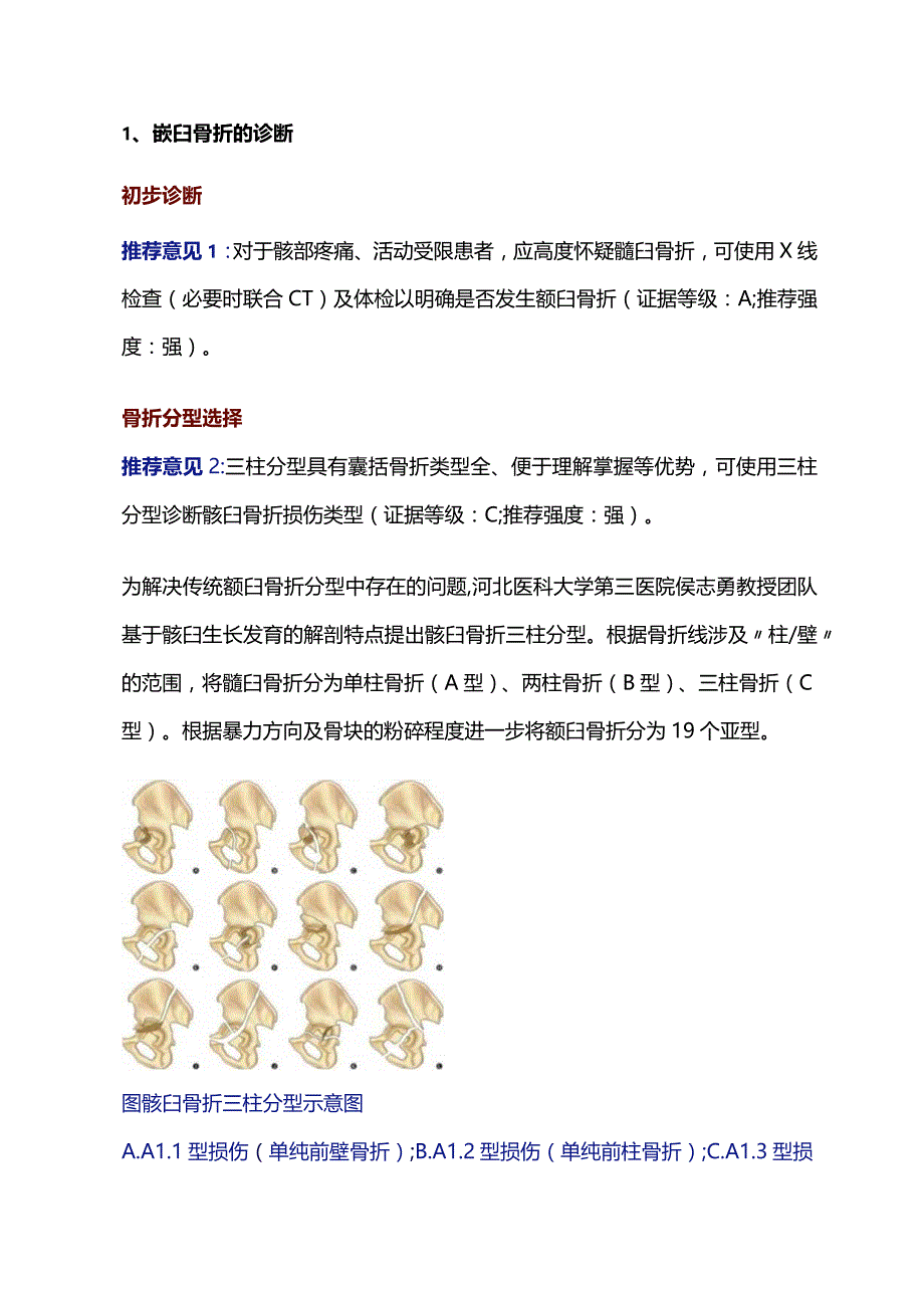 基于三柱分型的髋臼骨折精准诊疗专家共识（2023版）推荐意见.docx_第2页